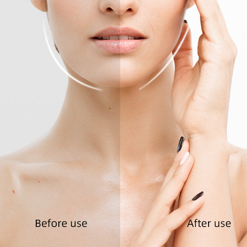 Face Lifting Tapes