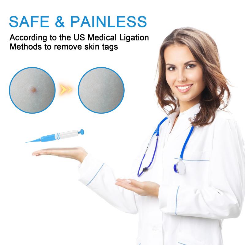Moles Skin Tag Warts Remover Device for Medium/Large Skin Tags Wart