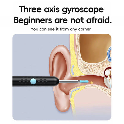 SmartScan Wireless Ear Cleaner with Camera