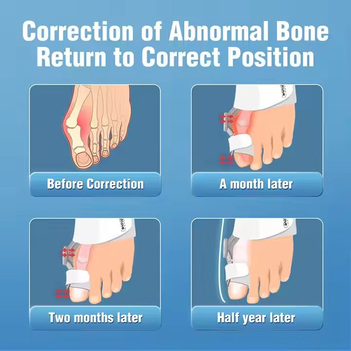 Toe Corrector
